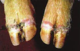 fmd foot